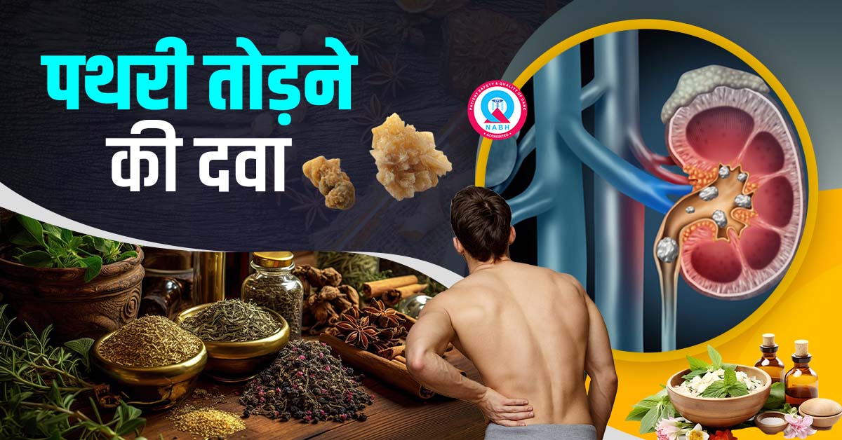 पथरी तोड़ने की दवा - Pathri Todne ki Dawa